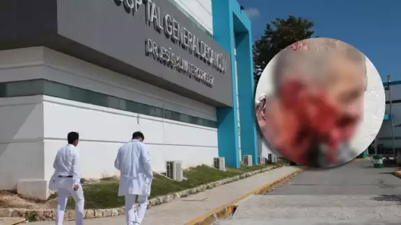 El adulto mayor fue internado de emergencia en el Hospital General de Cancún tras el ataque del perro pitbull, donde será sometido a una cirugía reconstructiva El adulto mayor fue internado de emergencia en el Hospital General de Cancún tras el ataque del perro pitbull, donde será sometido a una cirugía reconstructiva