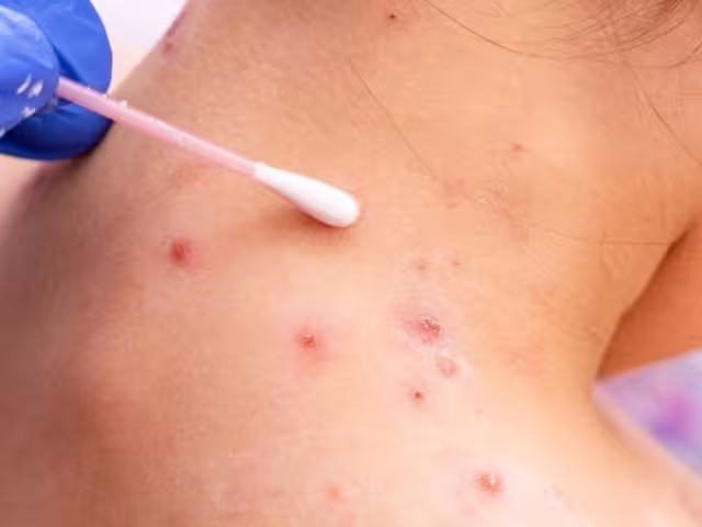 Quintana Roo registró 8 casos ambulatorios