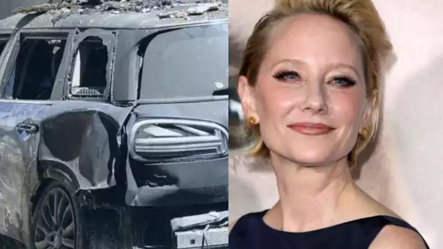 Anne Heche fue rescatada luego de una hora para controlar las llamas, por lo que sufrió quemaduras tras el accidente