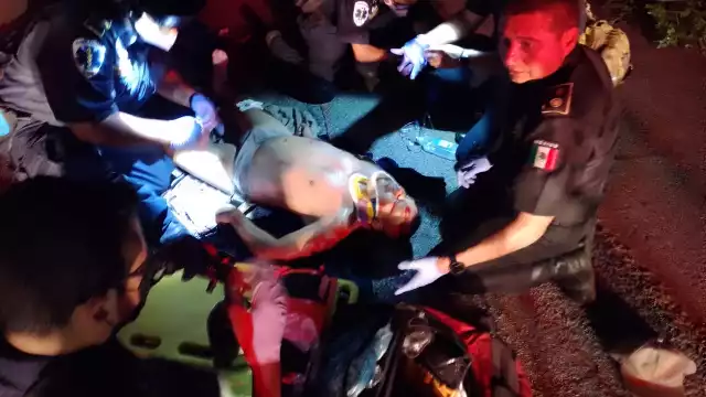 Vehículo embiste a motociclista y lo deja gravemente herido en Mérida