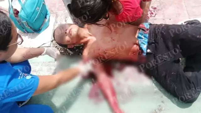 El joven que se lastimó con un cristal en Cozumel fue atendido por paramédicos y llevado a un hospital de la ciudad