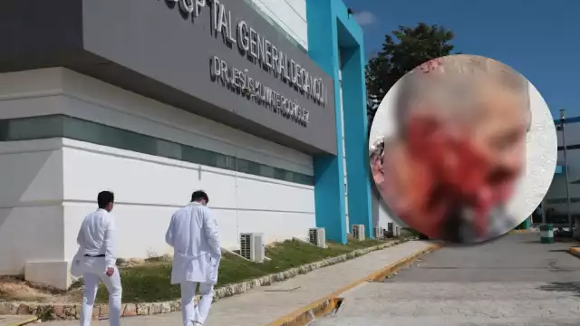 El adulto mayor fue internado de emergencia en el Hospital General de Cancún tras el ataque del perro pitbull, donde será sometido a una cirugía reconstructiva
