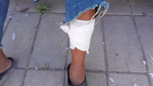 El hombre de la tercera edad pide a los ciudadanos a que mantengan a sus perros en el interior de sus casas