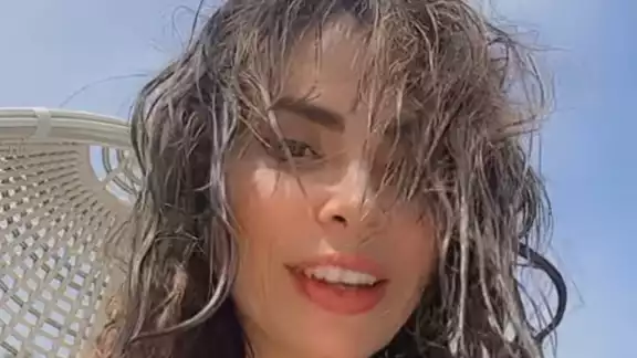El rostro de Gloria Trevi dio de qué hablar El rostro de Gloria Trevi dio de qué hablar