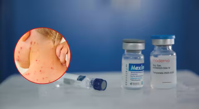 Durante las campañas también se aplicarán vacunas rubéola y parotiditis