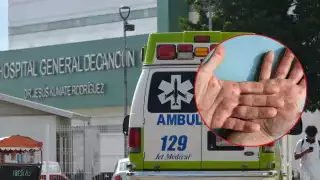 Confirman dos casos nuevos de mpox en Quintana Roo, suman 19 contagios: SINAVE