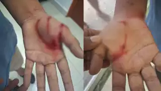 Menor sufre ataque de un perro en el fraccionamiento Galaxia I de Playa del Carmen