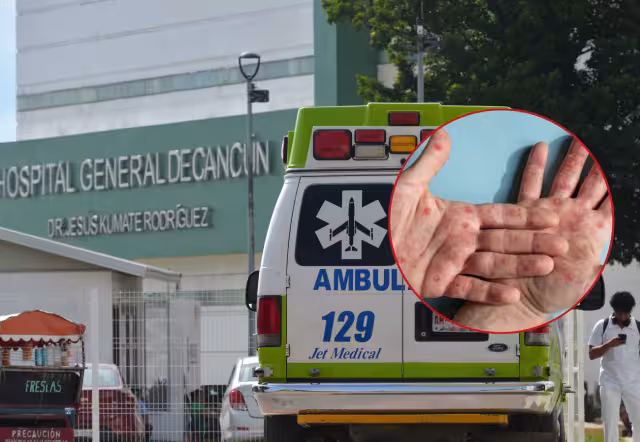 De acuerdo con reportes, todos los pacientes con lesiones en la piel son hombres; con mayor incidencia en la zona norte
