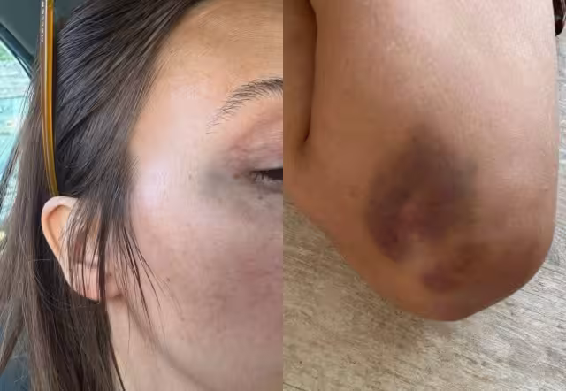 La víctima denunció la reclasificación de su caso