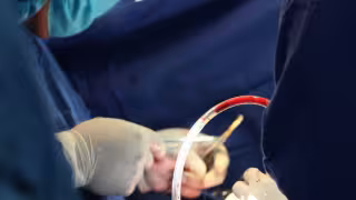 El trasplante de corazón lo realizó un equipo de especialistas de la Unidad Médica de Alta Especialidad del IMSS en la CDMX