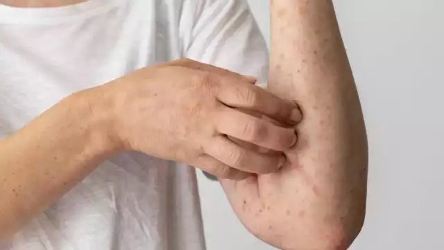 Quintana Roo registró una tasa de incidencia del 8.17%