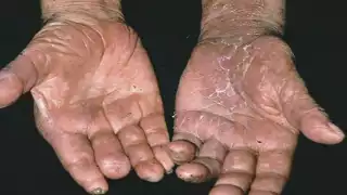 El estado más afectado en  2020 ha sido Sinaloa Foto: Gobierno de México