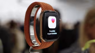 Apple Watch Series 12: los 5 cambios que Apple necesita para no quedarse atrás