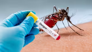 Dengue en Yucatán 2026: Investigan 5 muertes sospechosas y más de mil 500 casos probables