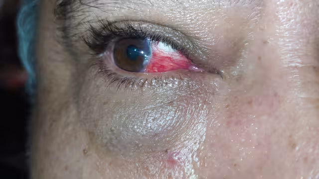 El suegro de la denunciante, un hombre mayor puede perder la visión debido a que le desprendieron la retina durante la golpiza policial