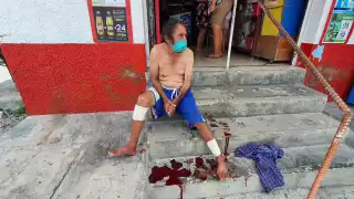 Pitbull ataca a hombre de 79 años en Cozumel, Quintana Roo