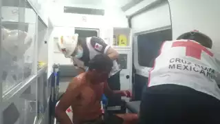 El hombre terminó con la nariz casi desprendida por completo, heridas en el cuerpo y extremidades