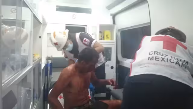 El hombre terminó con la nariz casi desprendida por completo, heridas en el cuerpo y extremidades