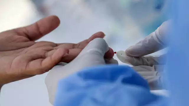 El Virus de la Inmunodeficiencia Humana registra 444 casos en lo que va del año, 391 son hombres y 53 mujeres; mientras que en el 2022 hubo 472 contagios