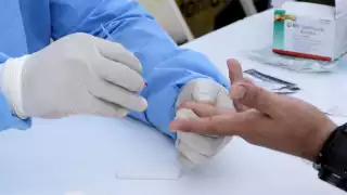 Quintana Roo lidera cifra de contagios de ETS en la Península de Yucatán: Sinave