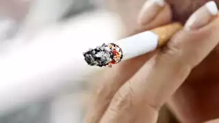 Las personas consideran que la extracción dental es un procedimiento muy desagradable