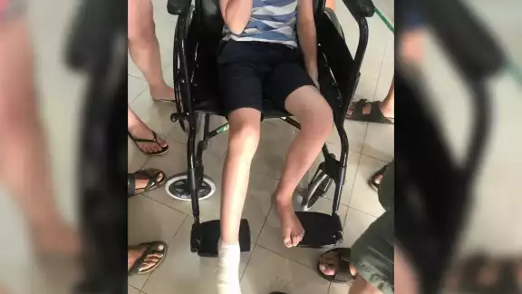 Tras la nula atención en la Cruz Roja, el niño fue atendido en la Clínica San Miguel de Cozumel, donde su pie fue suturado para cerrar la herida tras el corte que le hizo la propela de la embarcación Tras la nula atención en la Cruz Roja, el niño fue atendido en la Clínica San Miguel de Cozumel, donde su pie fue suturado para cerrar la herida tras el corte que le hizo la propela de la embarcación