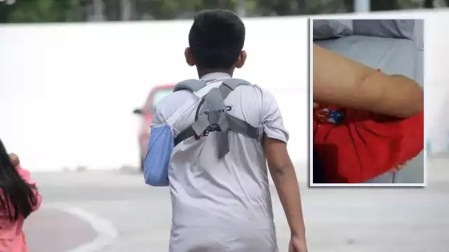 El menor víctima de bullying en Chetumal estuvo internado por dos meses, luego de que el mismo agresor lo golpeara