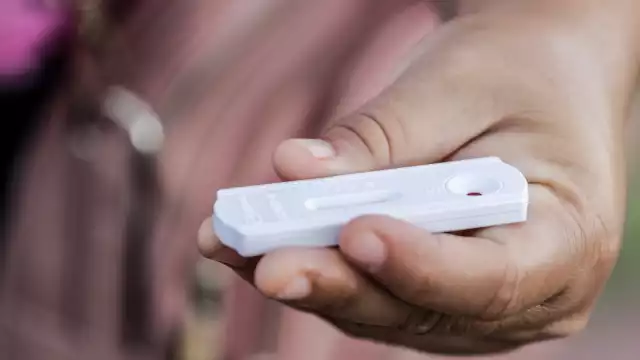 Los resultados de estas pruebas son entregados luego de aproximadamente 10 minutos después de ser aplicadas