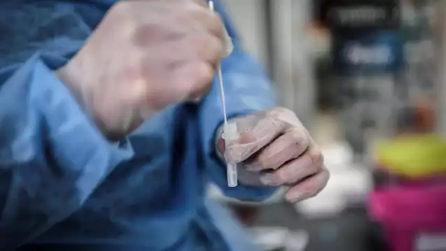 Un grupo de científicos de Marsella registraron una variante con más mutaciones que Ómicron y que fue localizada por primera vez en la República del Congo.