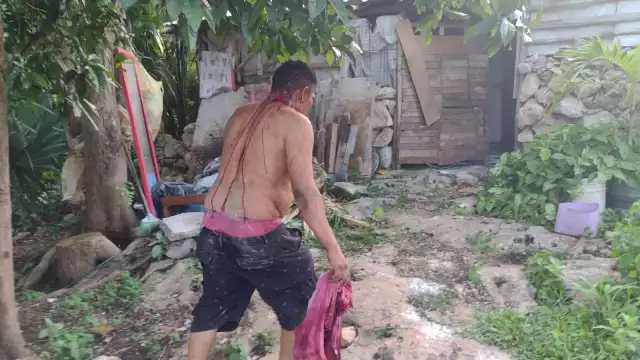 Los heridos presentaron cortadas en la cabeza. Foto: Justino Xiu Chan