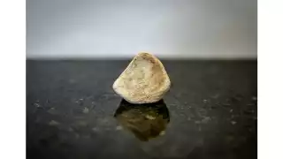 El padecimiento conocido como “piedras en los riñones” es muy común en el Estado