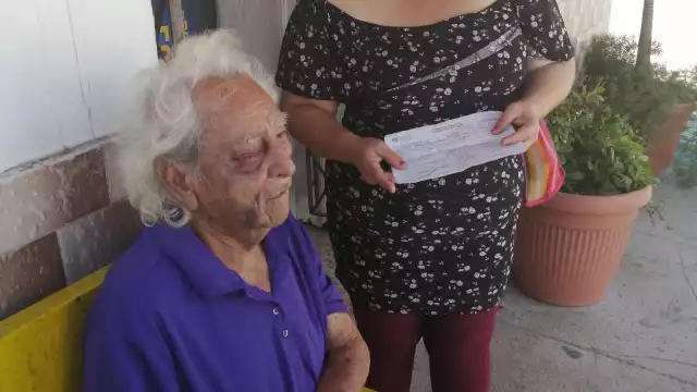 El artesano de 91 años podría perder la vista a causa del ataque