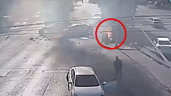 El hombre presentó quemaduras en el 70% de su cuerpo