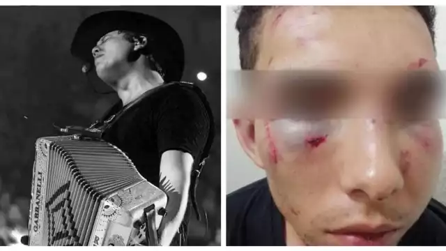 Remy Valenzuela y Carlos "N"