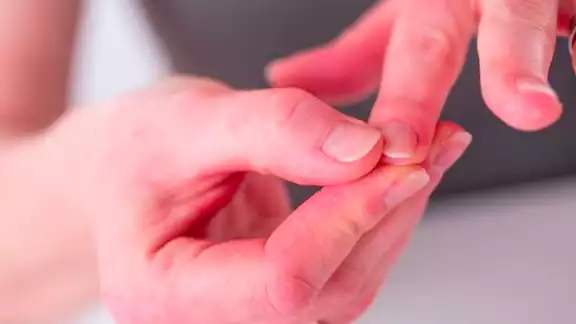 Un estudio aún en proceso podría determinar si estás contagiado de COVID-19 a través de tus uñas