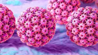 Yucatán registra en el 2025 un aumento de 96% en casos de Virus del Papiloma Humano