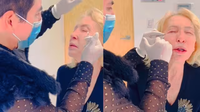Laura Bozzo se somete a cirugía estética de rostro