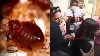 Captan chinche en cabello de alumna de la UNAM