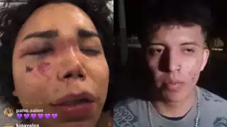 Paola Suárez confirma demanda en contra de su agresor