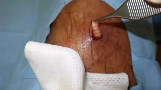 El especialista asegura que la plaga no está fuera de control, sin embargo, no está exenta de propagarse aún con todas las previsiones