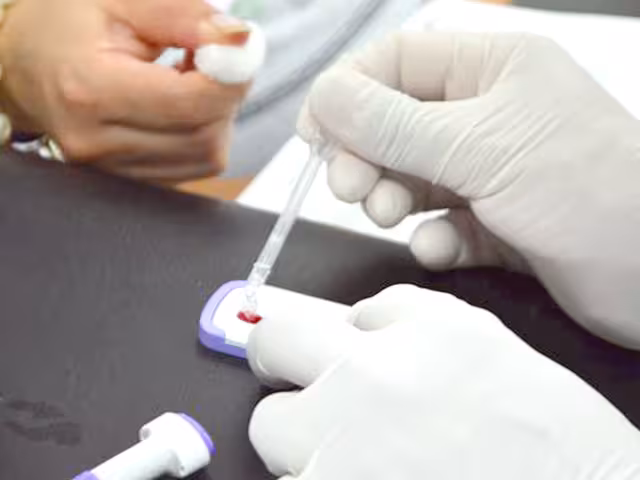 Debido a la alta incidencia, la entidad sobresale a nivel nacional, pero debido al desabasto de pruebas no hay forma de preveni