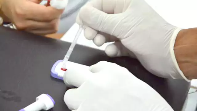 Debido a la alta incidencia, la entidad sobresale a nivel nacional, pero debido al desabasto de pruebas no hay forma de preveni