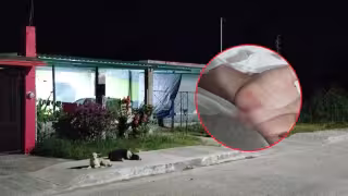 Niño es brutalmente atacado por perro en Escárcega; dueño se niega a pagar gastos médicos