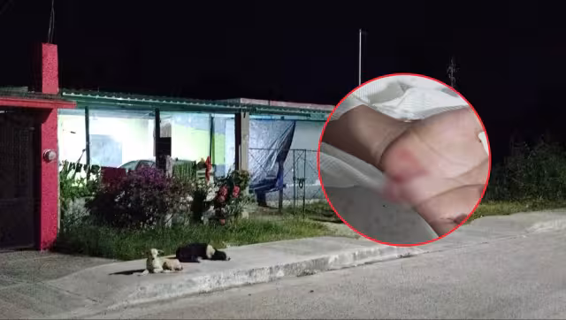 Campeche registra 9 casos confirmados de sarampión en 2026.