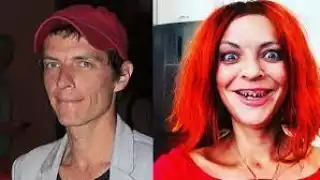 Una foto en Instagram llamó particularmente la atención, donde aparece con un body blanco, demacrado y con extraños piquetes en el brazo.
