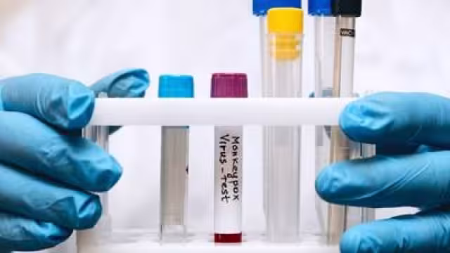 Europa ha sido más afectado por la viruela del mono