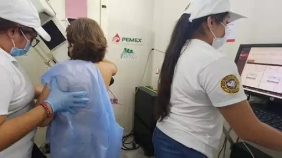 Detectan aumento de cáncer de mama en zonas rurales de Carmen Detectan aumento de cáncer de mama en zonas rurales de Carmen