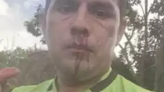 La agresión dejó tirado al árbitro en el campo, además que se tuvo que suspender el partido