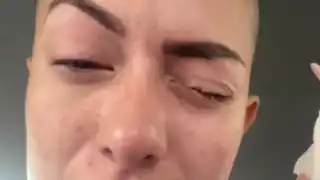 Confunde Kola Loka con sus gotas para los ojos y para en el hospital: VIDEO