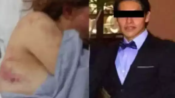 El pasado 8 de noviembre de 2108 Christian Contreras golpeó salvajemente a su novia El pasado 8 de noviembre de 2108 Christian Contreras golpeó salvajemente a su novia